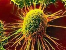  چاقی سلول‌ها را سرطانی می‌کند/اثر "متفورمین" در کاهش ابتلا به سرطان سینه