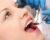 پوکی استخوان,دیابت,زوال عقل,بیماری هایی که از طریق دندان‌ها مشخص می‌شوند,معاینه دندان ها,shabnamha.ir,شبنم همدان,afkl ih